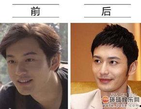 明星受伤的图片,明星意外受伤瞬间，伤痛背后的人生感悟