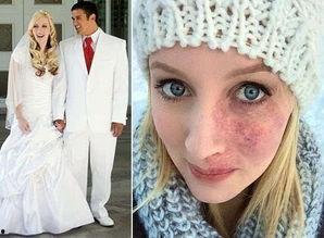 头条脸上有胎记的女人,揭开脸上有胎记女性的独特魅力